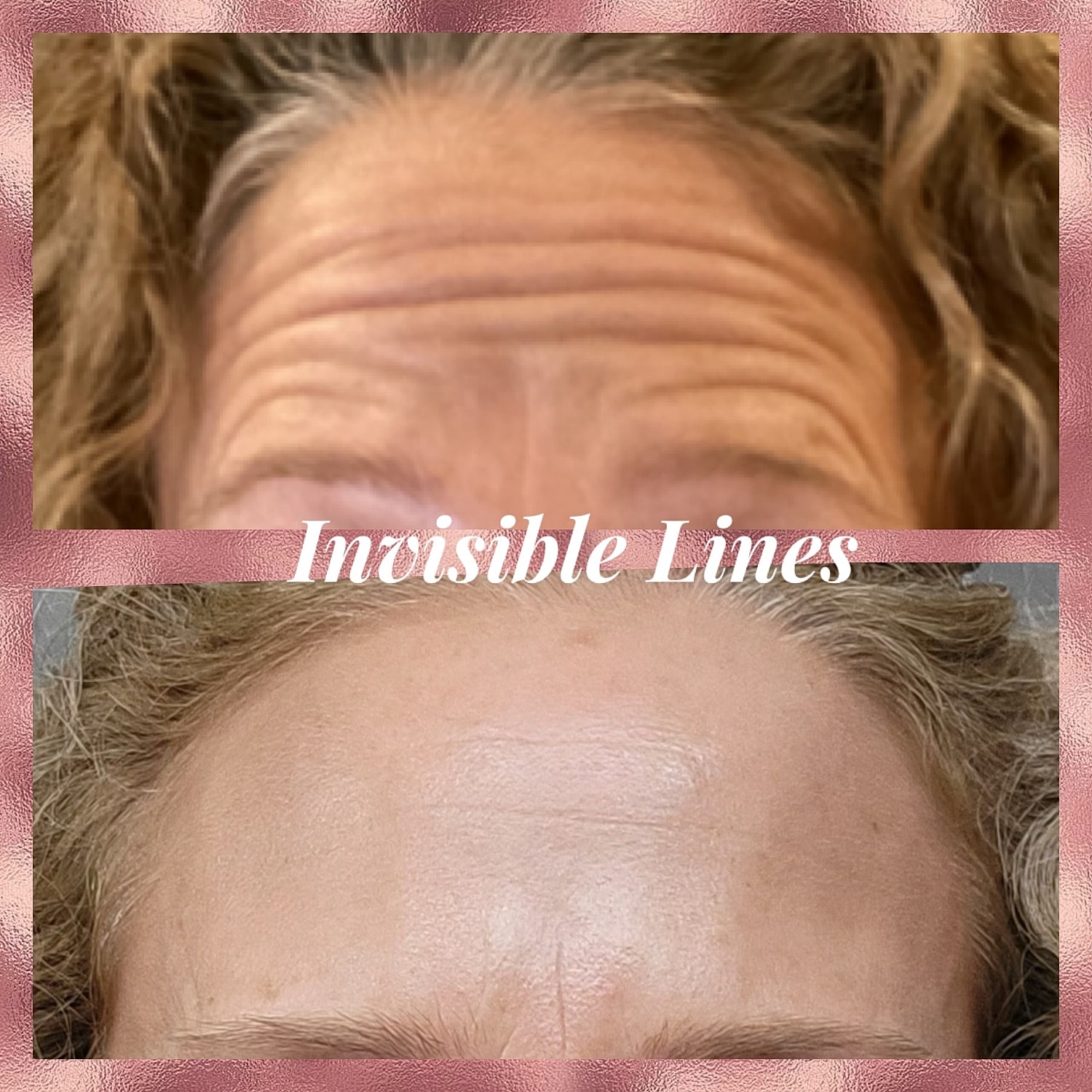 Toxins Before & After