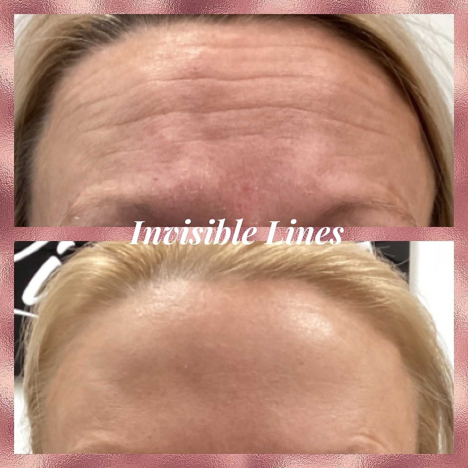 Toxins Before & After