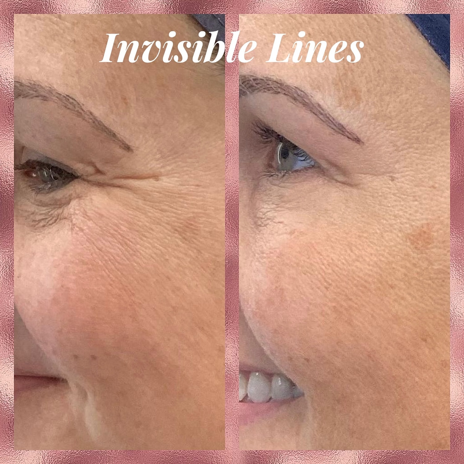Toxins Before & After