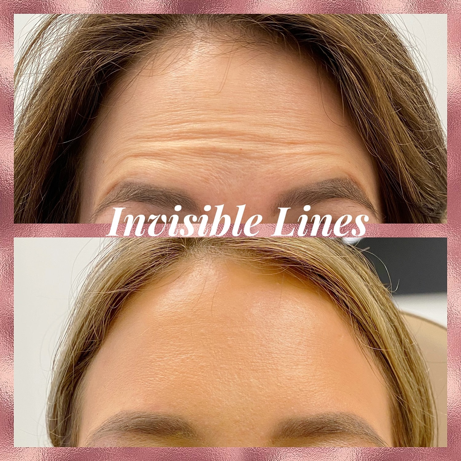 Toxins Before & After