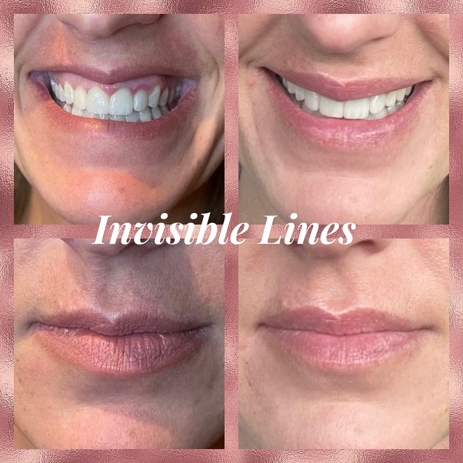 Toxins Before & After