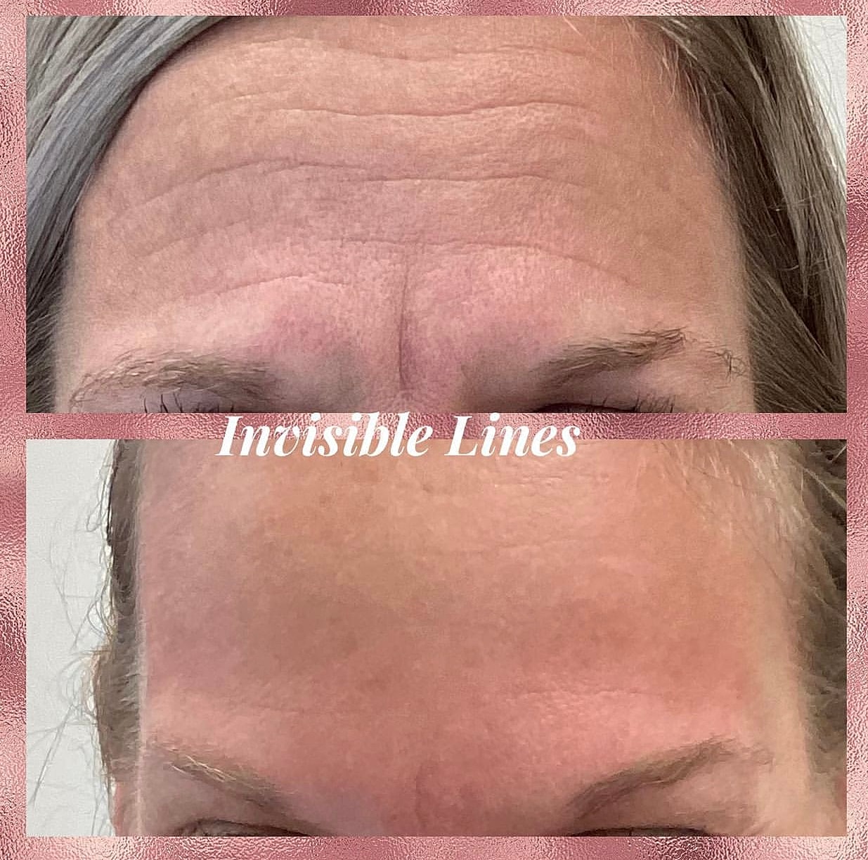 Toxins Before & After