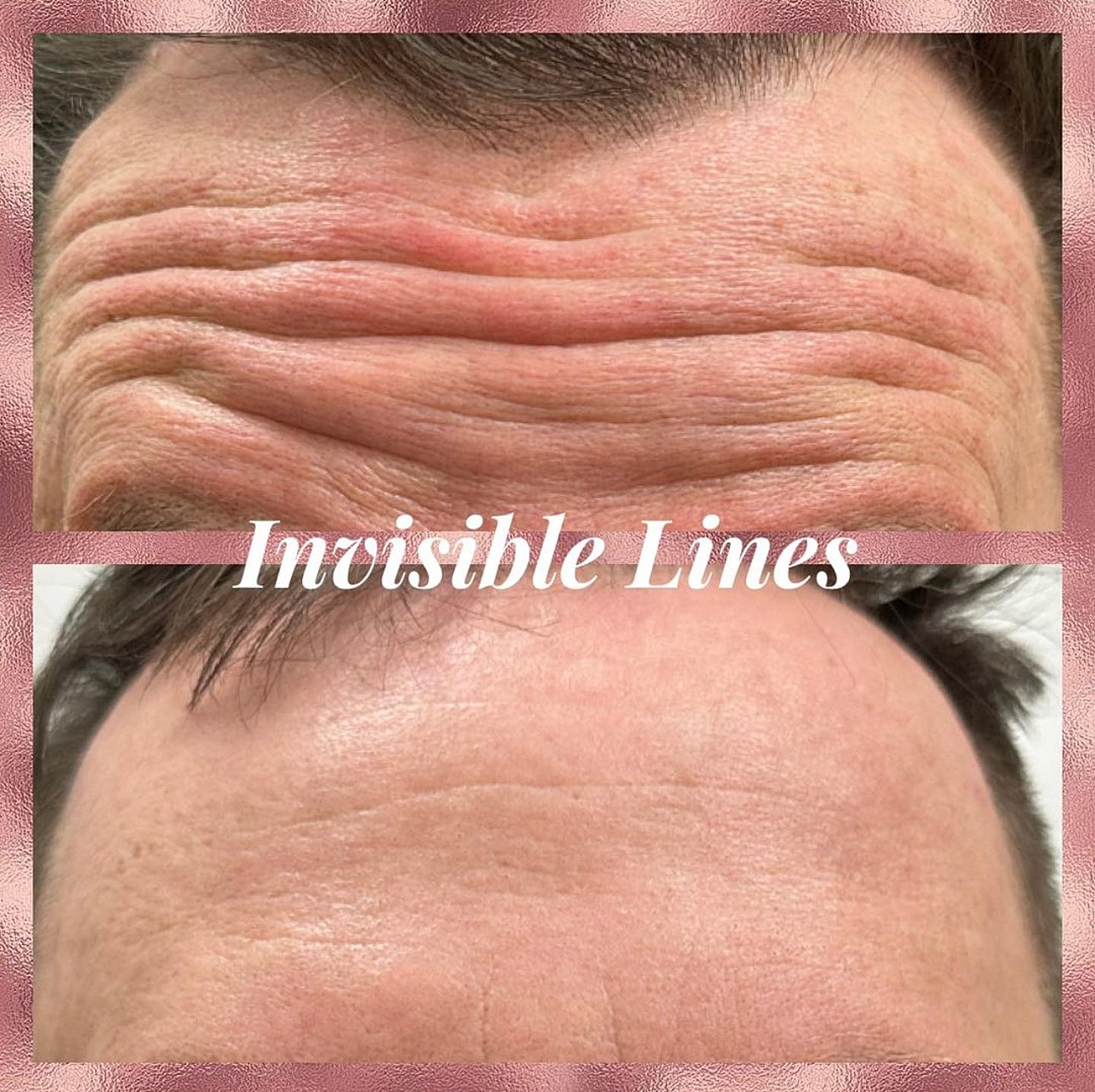 Toxins Before & After