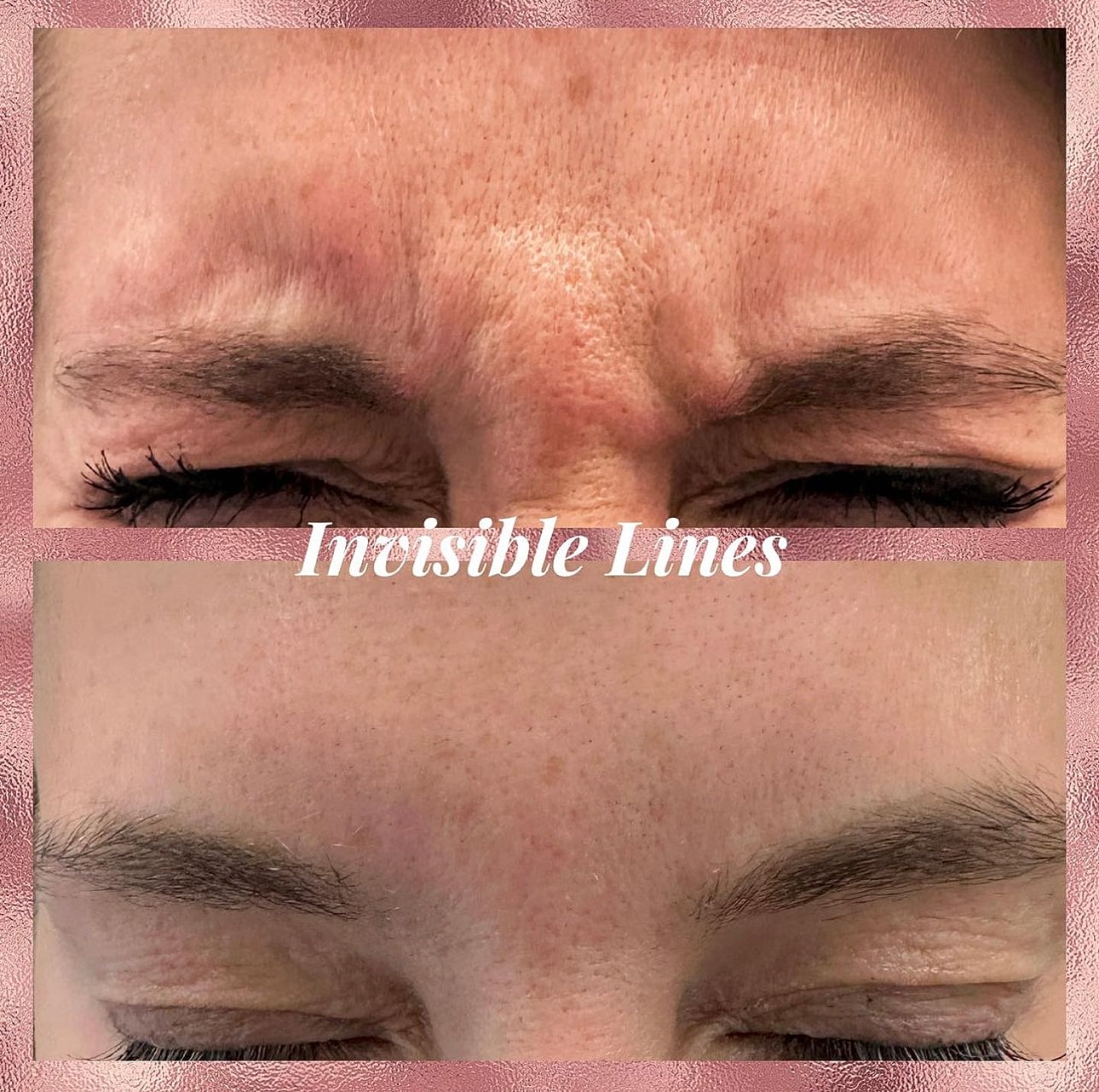 Toxins Before & After