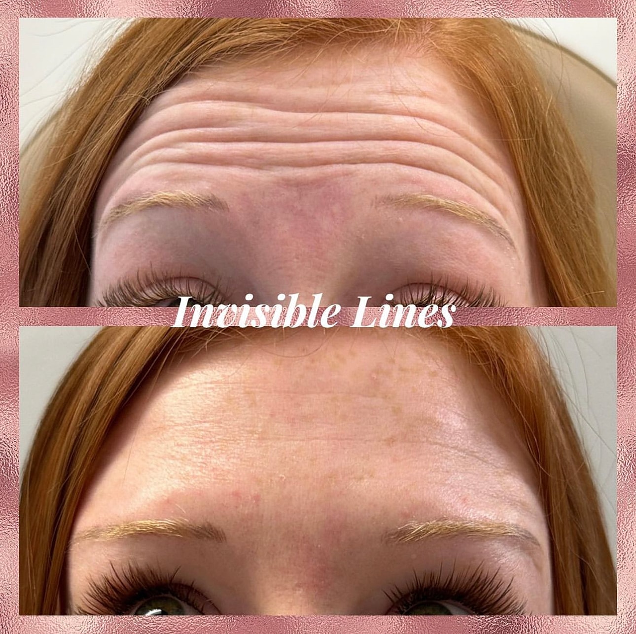 Toxins Before & After