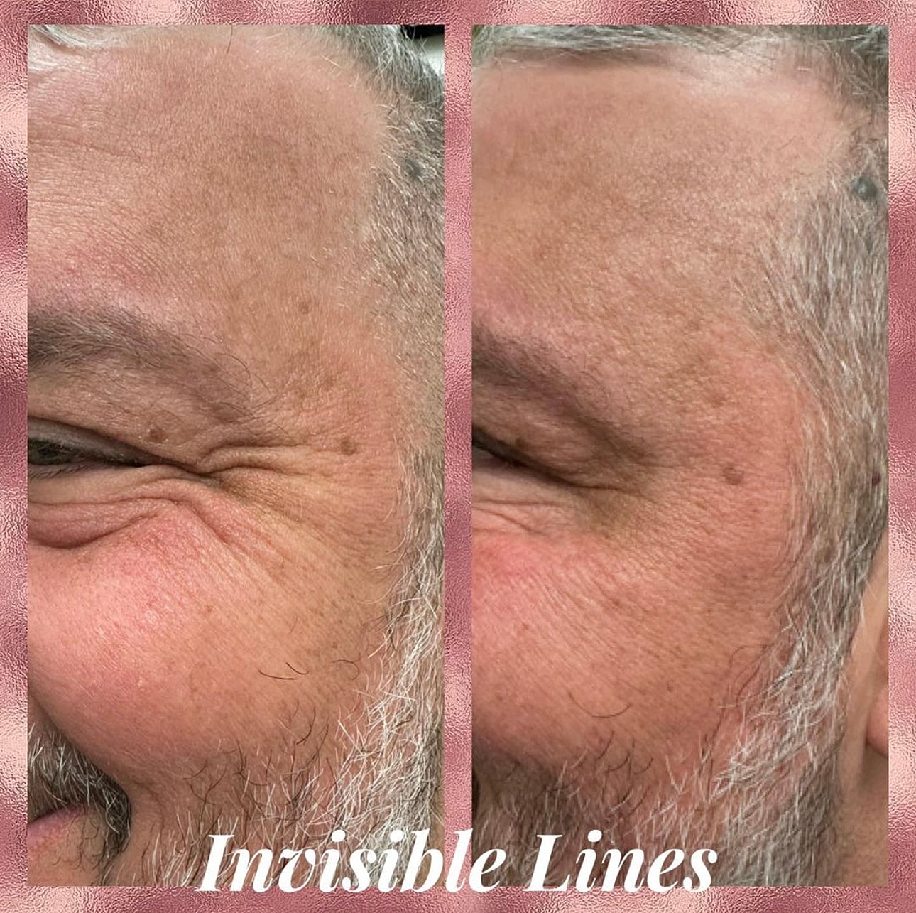 Toxins Before & After
