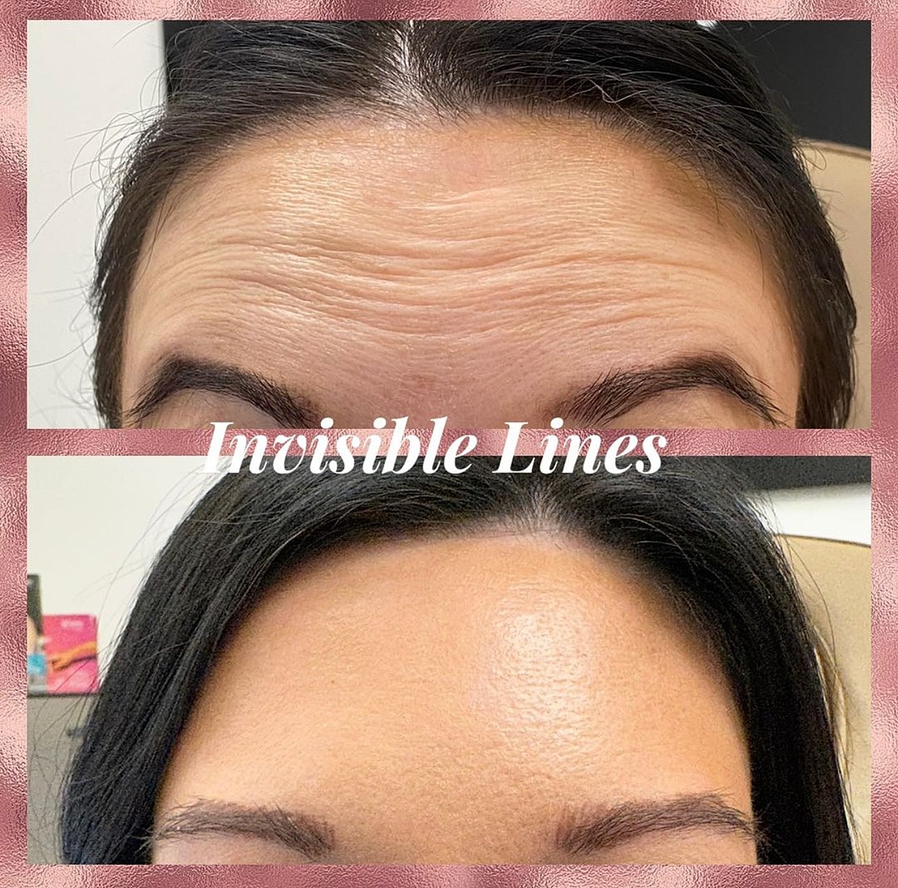 Toxins Before & After