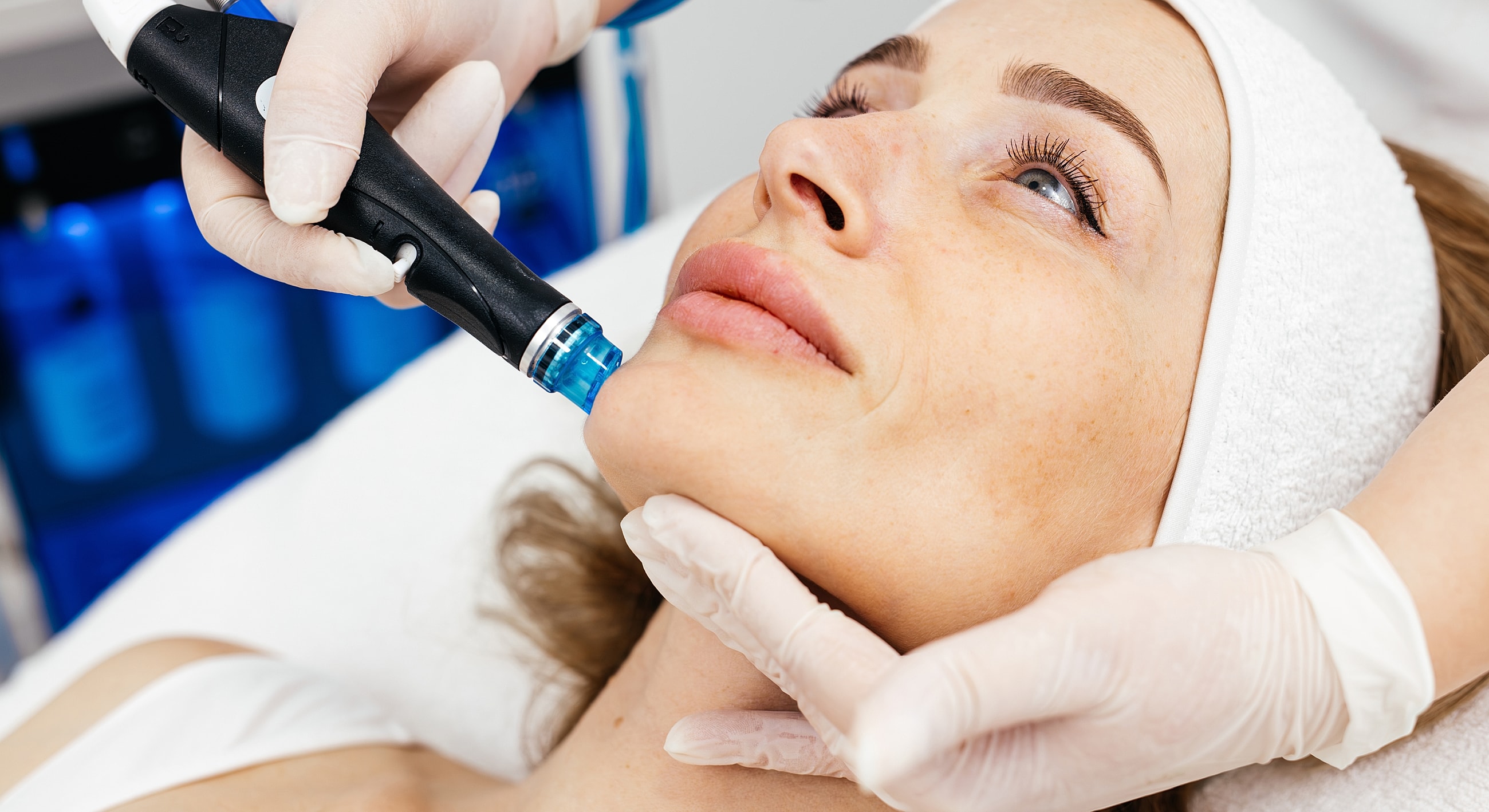 Microneedling facial treatment in a spa setting.